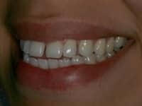 Konig Center for Cosmetic & Comprehensive Dentistry smile photos